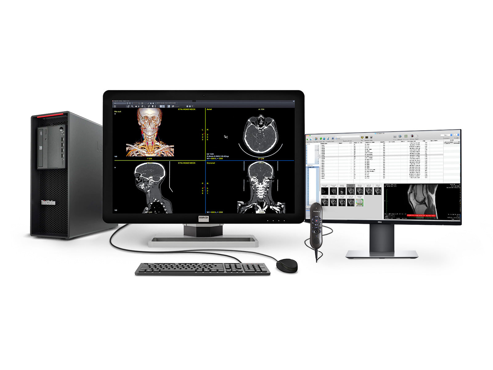 Estação de leitura de radiologia geral de Barco | Coronis 6MP MDCC-6430 | Estação de trabalho da HP | Nuance micring | Monitores de Lista de Trabalho de 24 "(6430Z4R)