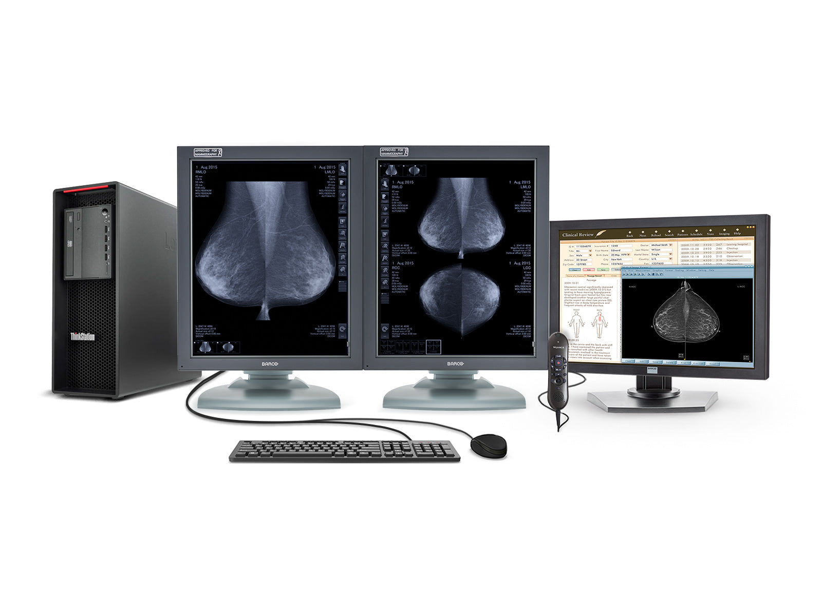 Complete Mammography Reading Station | Lenovo Workstation