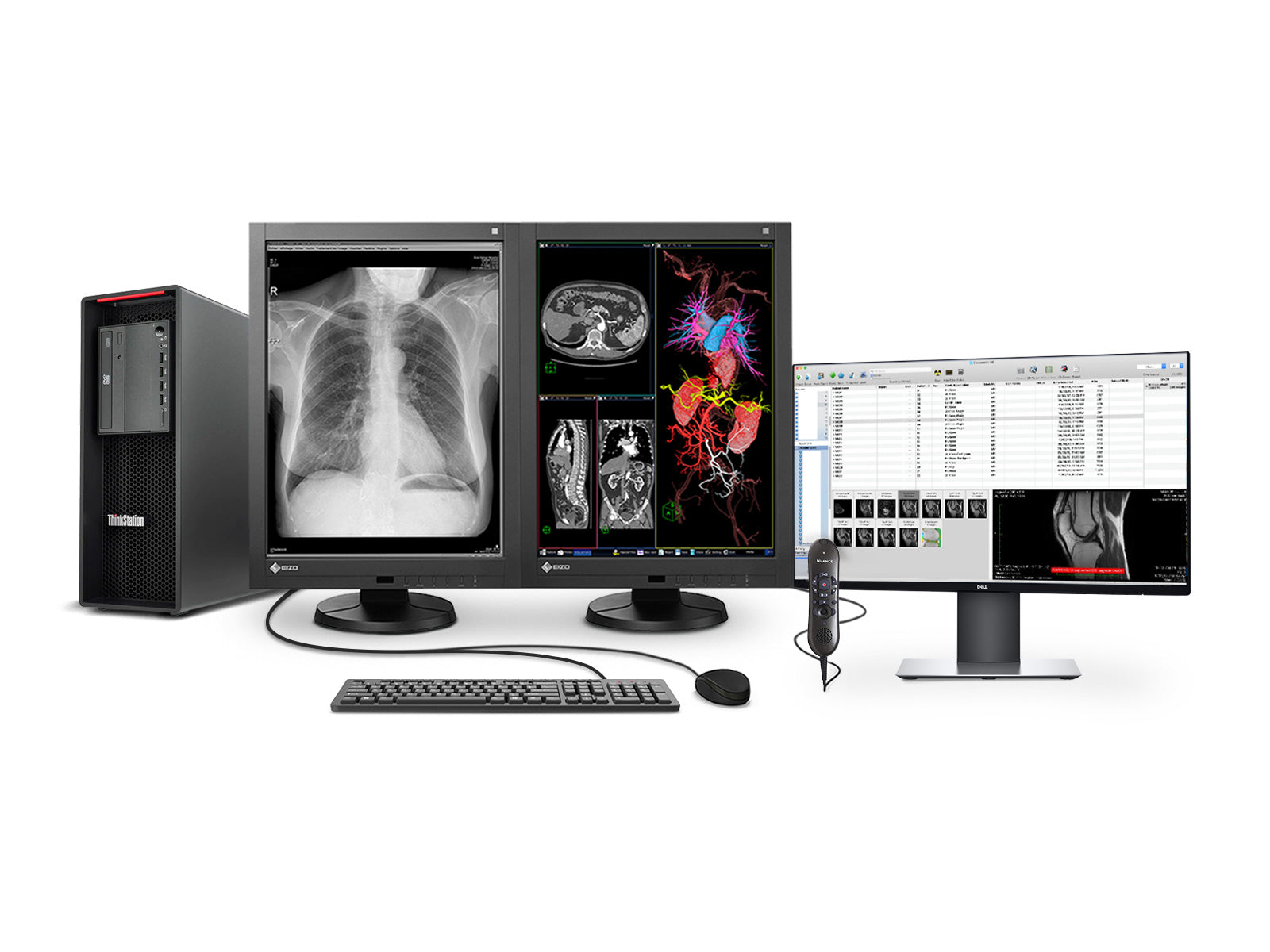 Eizo Complete PACS General Radiology Station | Lenovo Workstation