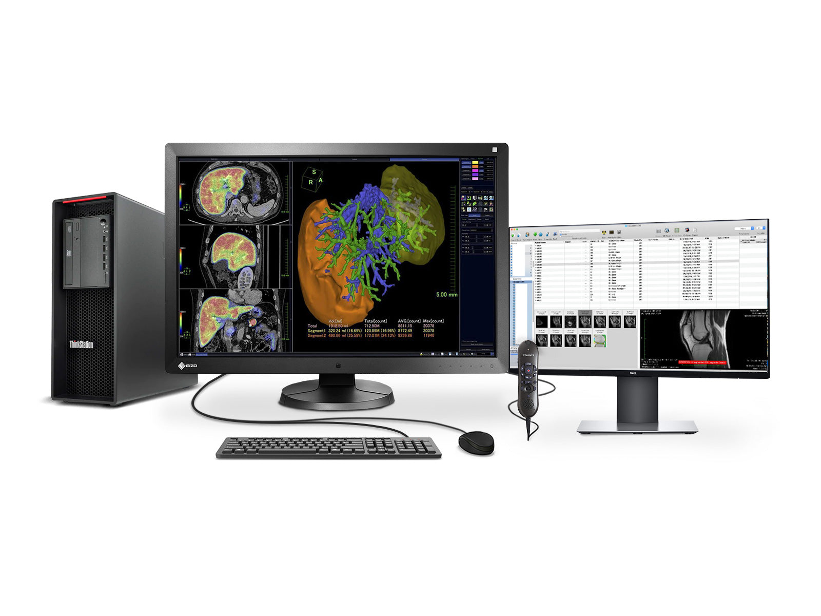 Complete PACS General Radiology Station | Lenovo Workstation