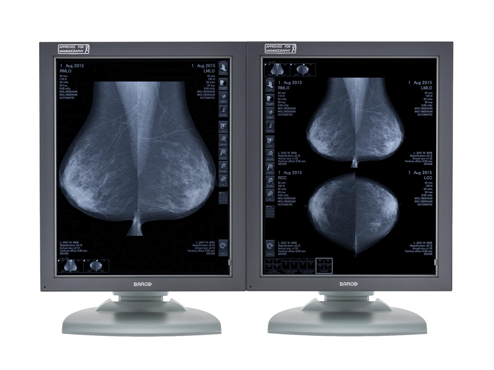 Complete Mammography Reading Station | Barco 5MP Grayscale Displays | HP Workstation | Dictation Mic | Worklist Monitor (MG5121Z4R) Monitors.com 