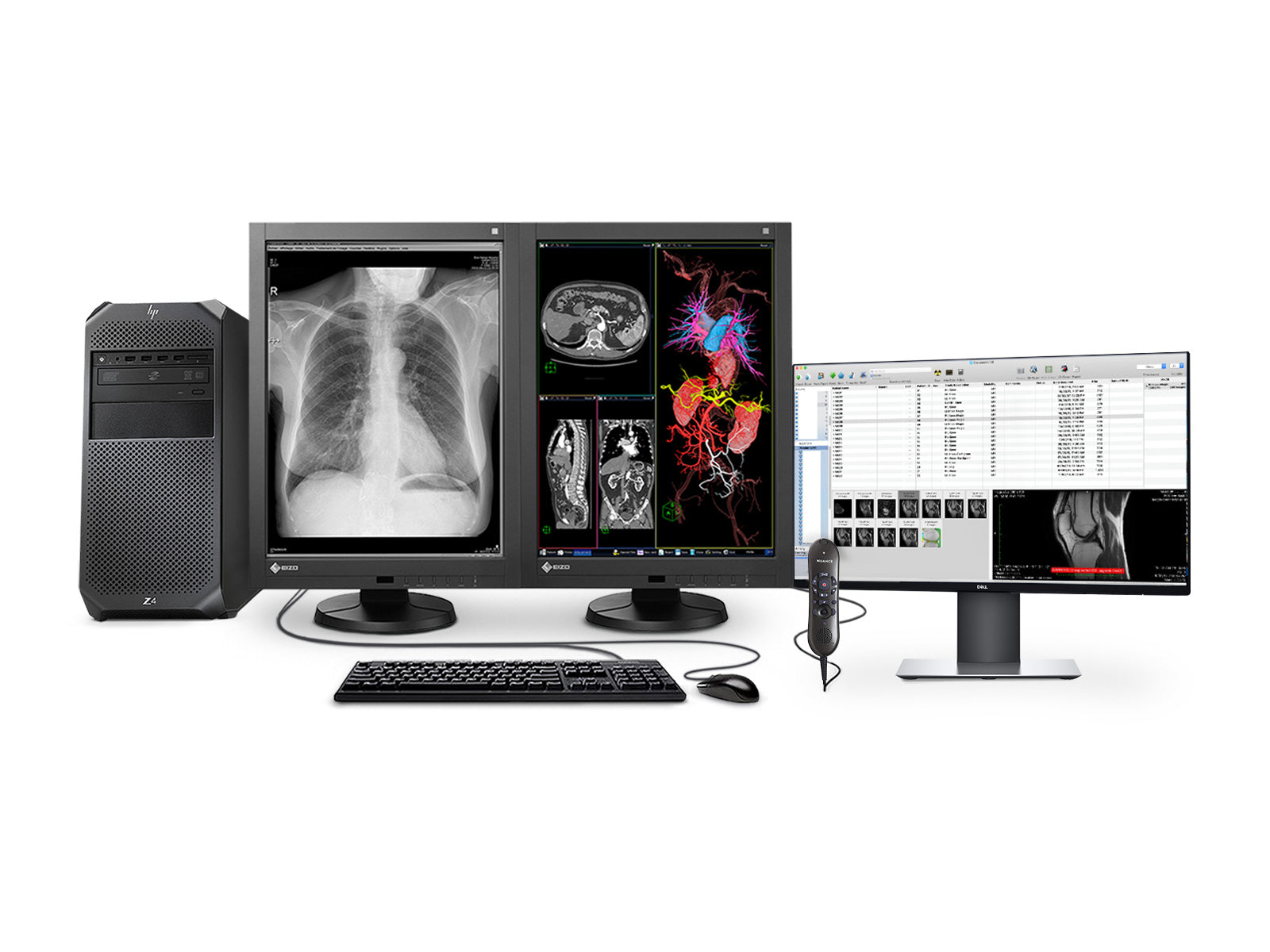 Eizo Complete PACS General Radiology Station | HP Workstation