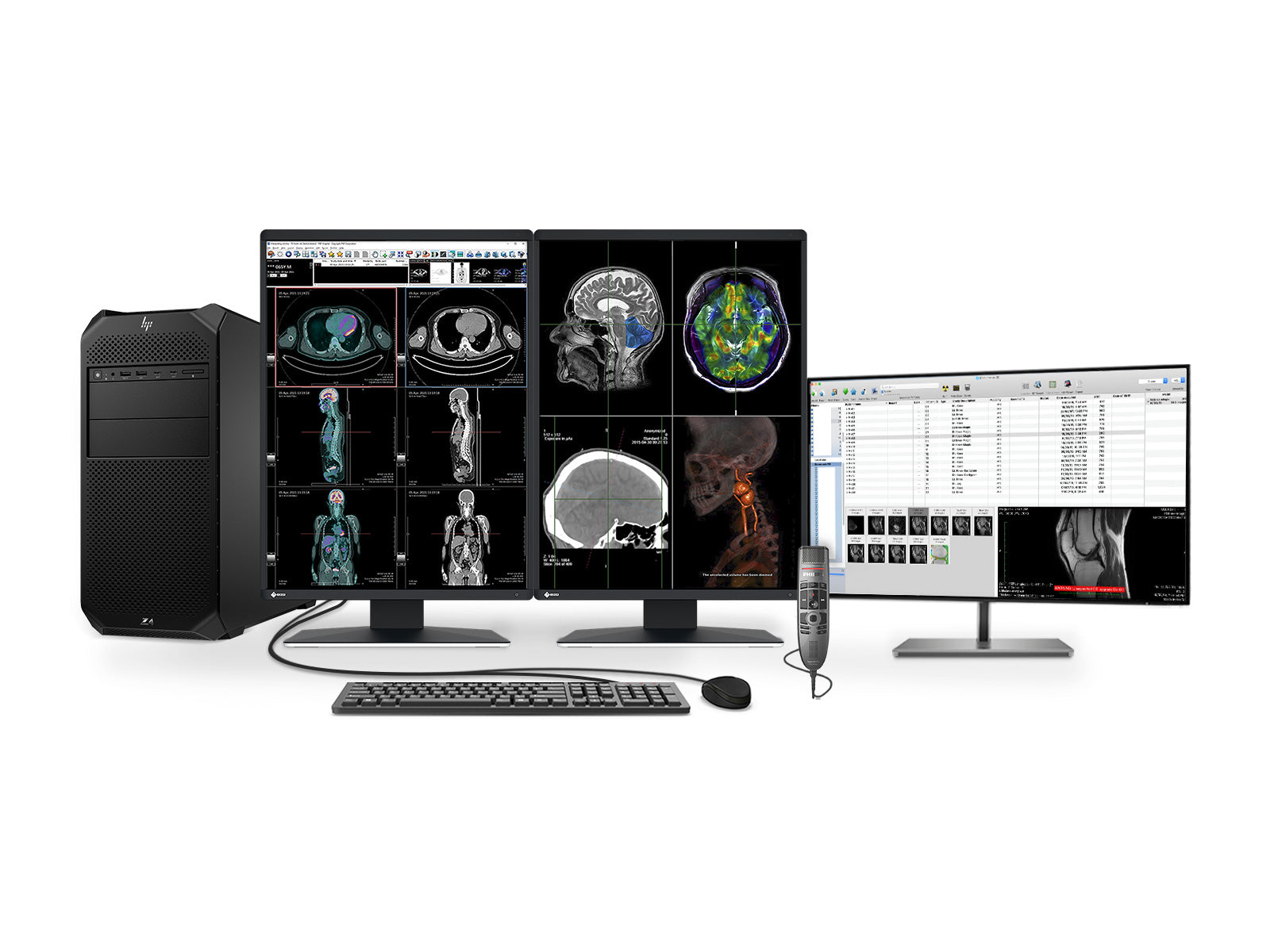 Complete PACS Gen Radiology Station | Eizo Displays | HP Workstation