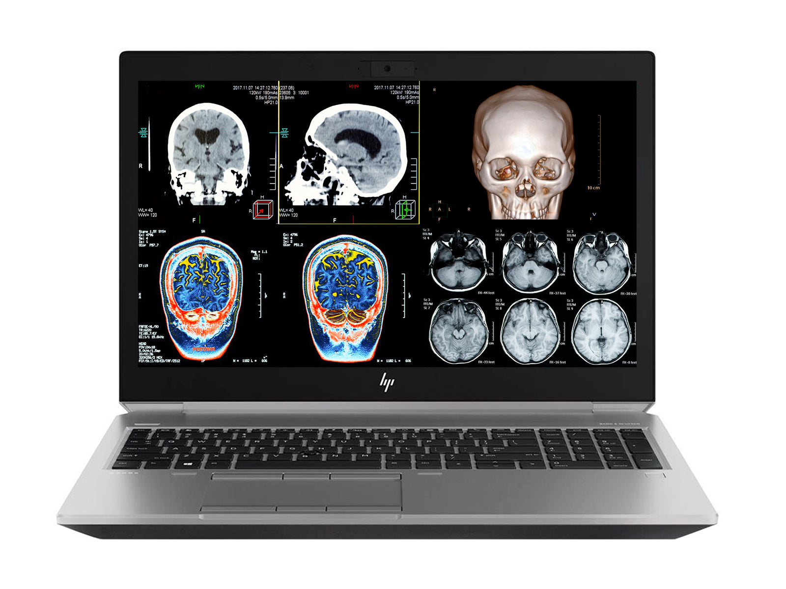 HP ZBook 15 G6 Mobile Radiology Workstation | 15.6" 8MP UHD DICOM Calibrated | Core i7-9850H @ 4.60GHz | 64GB DDR4 | 512GB NVMe SSD | NVIDIA Quadro RTX 3000 6GB | Win10 Pro Monitors.com 