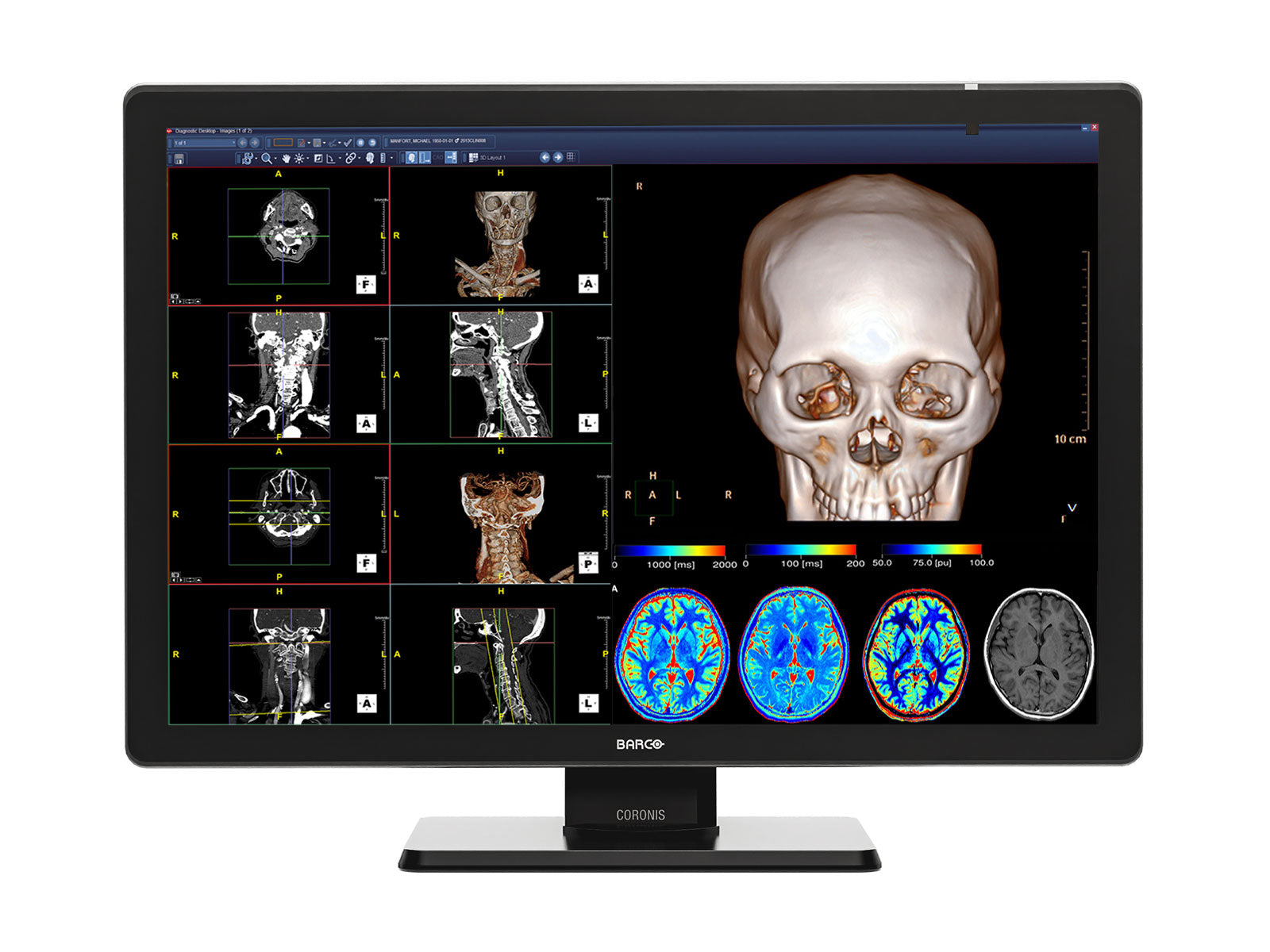 Barco Coronis Fusion MDCC-4430 4MP 30 "Display de diagnóstico médico LED LED