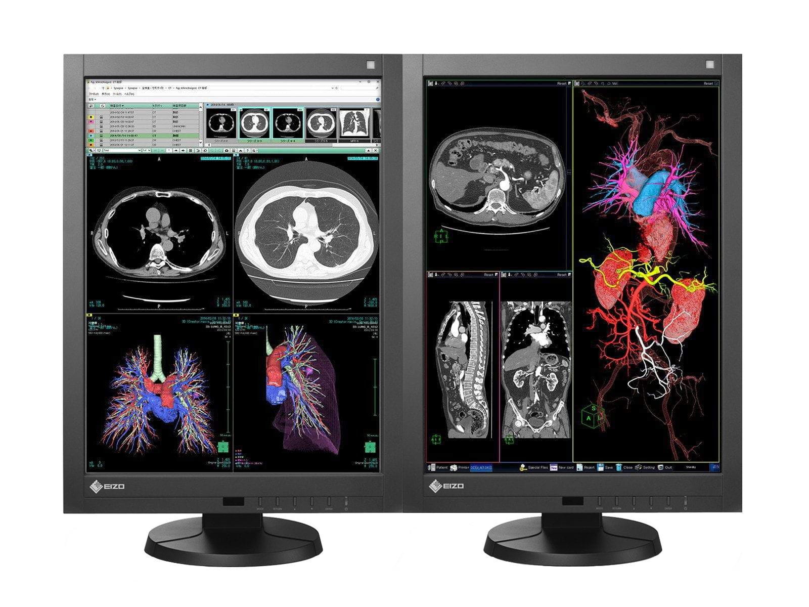 Eizo Complete PACS General Radiology Station | HP Workstation