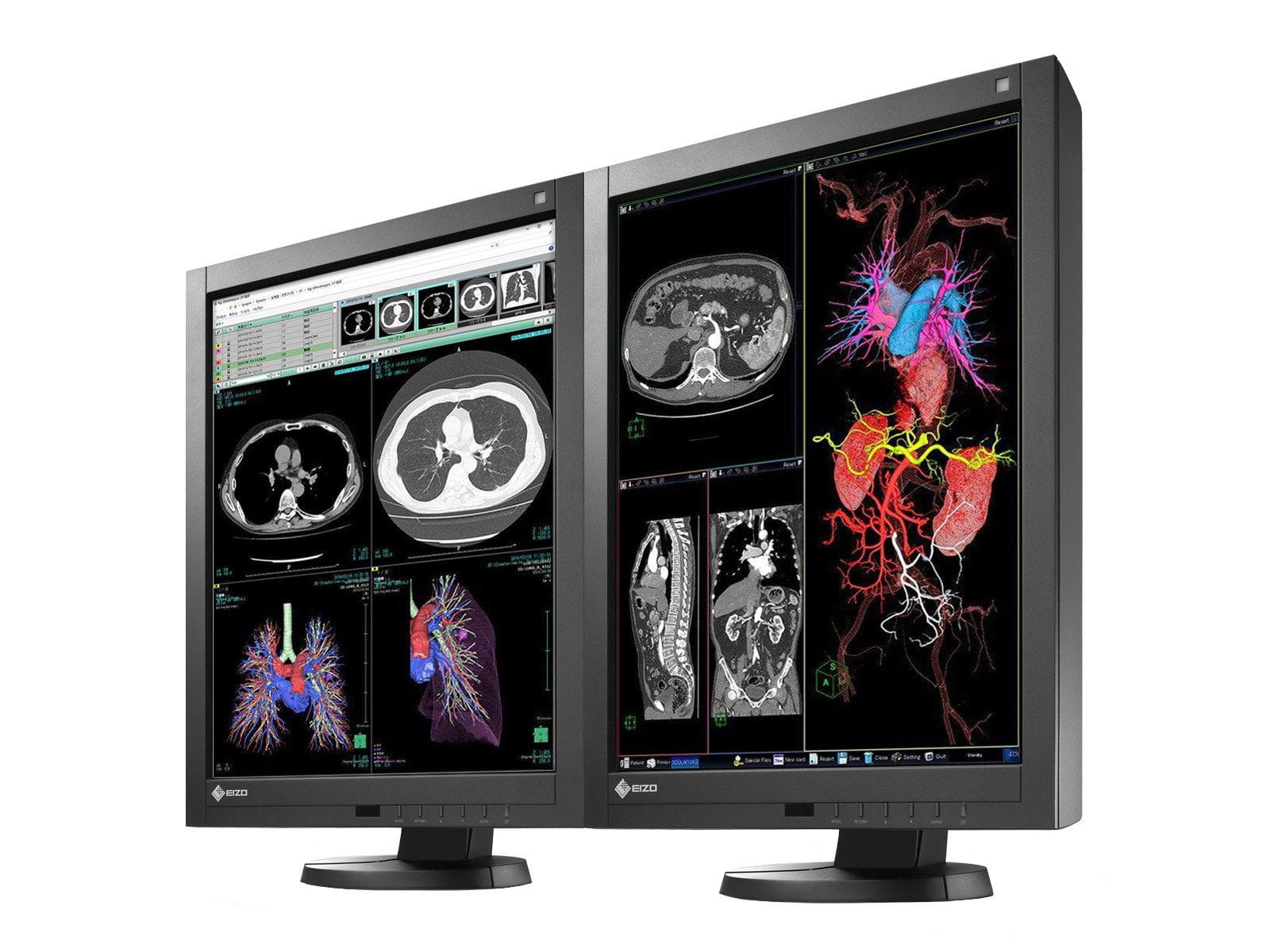 Eizo Complete PACS General Radiology Station | HP Workstation