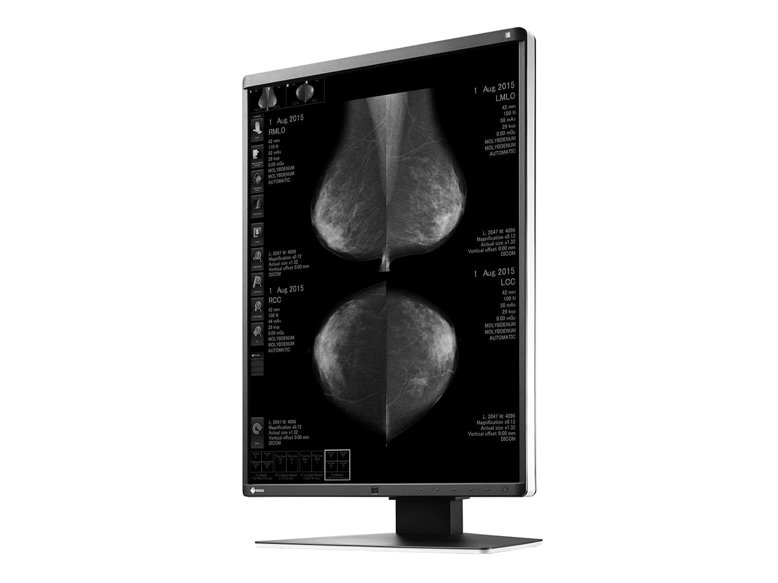 Eizo RadiForce GX560 5MP 21" LED Grayscale Mammo 3D-DBT Breast Imaging Display Monitor (GX560-MD) Monitors.com 