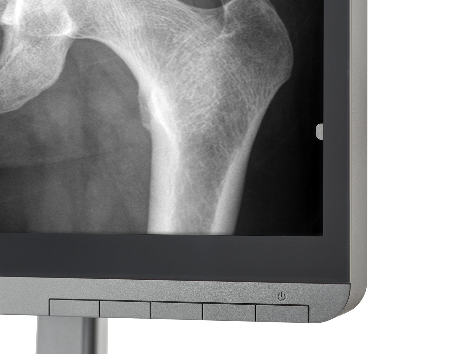 JVC Totoku MS-S200 2MP 21" Grayscale Diagnostic Radiology Display Monitor (MS-S200) Monitors.com 