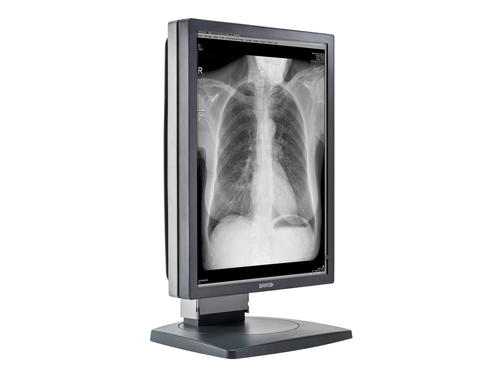 Barco Coronis MDCG-2121 2MP 21" Grayscale Diagnostic Radiology PACS Monitor Monitors.com 