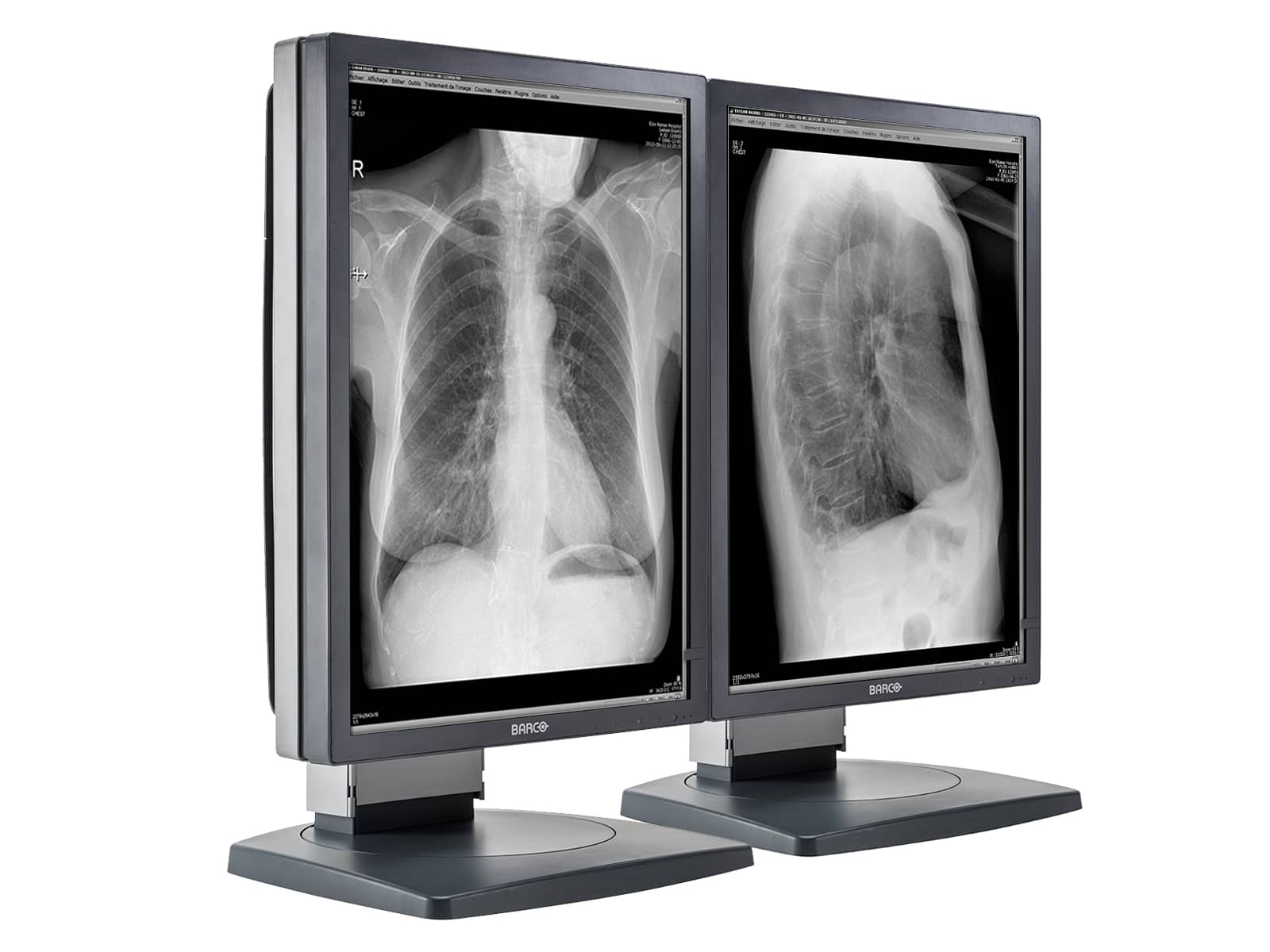 Barco Coronis MDCG-2121 2MP 21" Grayscale Diagnostic Radiology PACS Monitor Monitors.com 