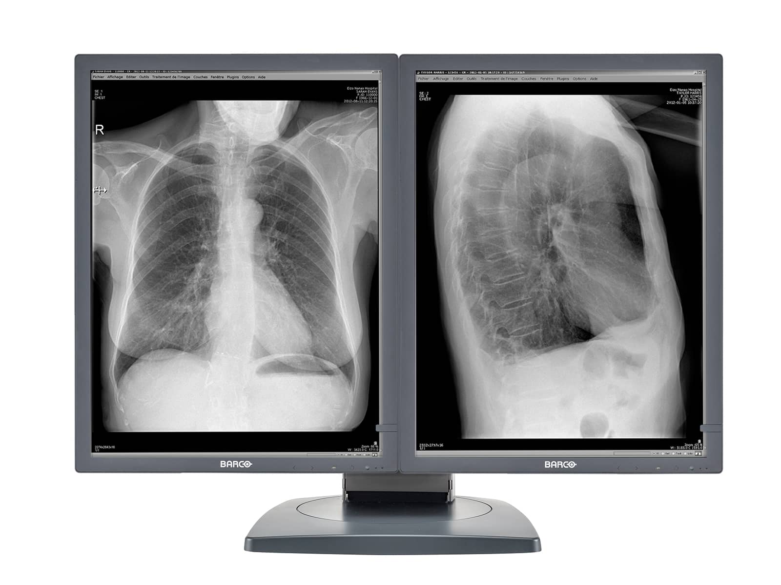 Barco Coronis MDCG-3120 3MP 20" Grayscale General Radiology Diagnostic Display Monitors.com 