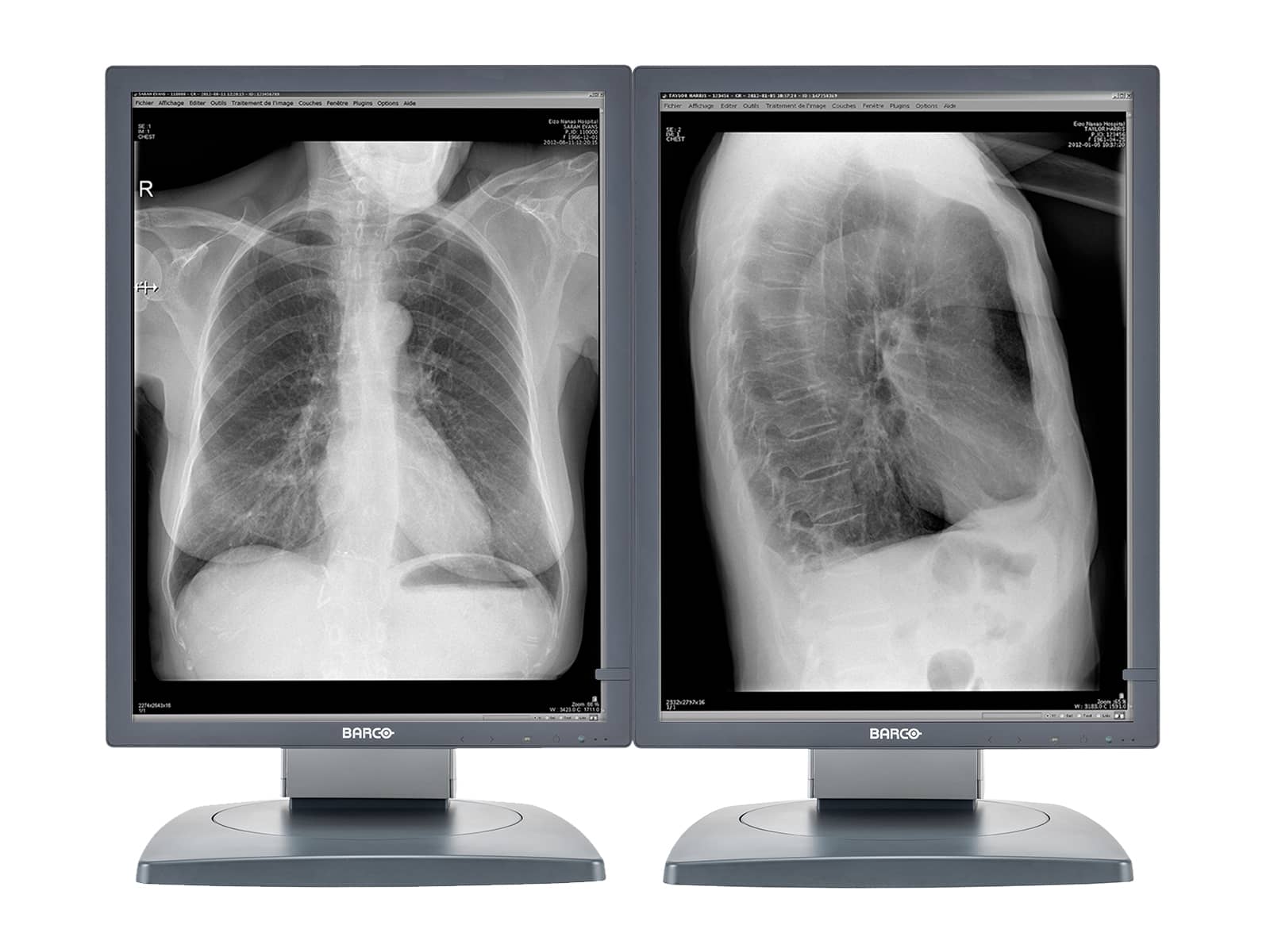 Barco Coronis MDCG-3120 3MP 20" Grayscale General Radiology Diagnostic Display Monitors.com 