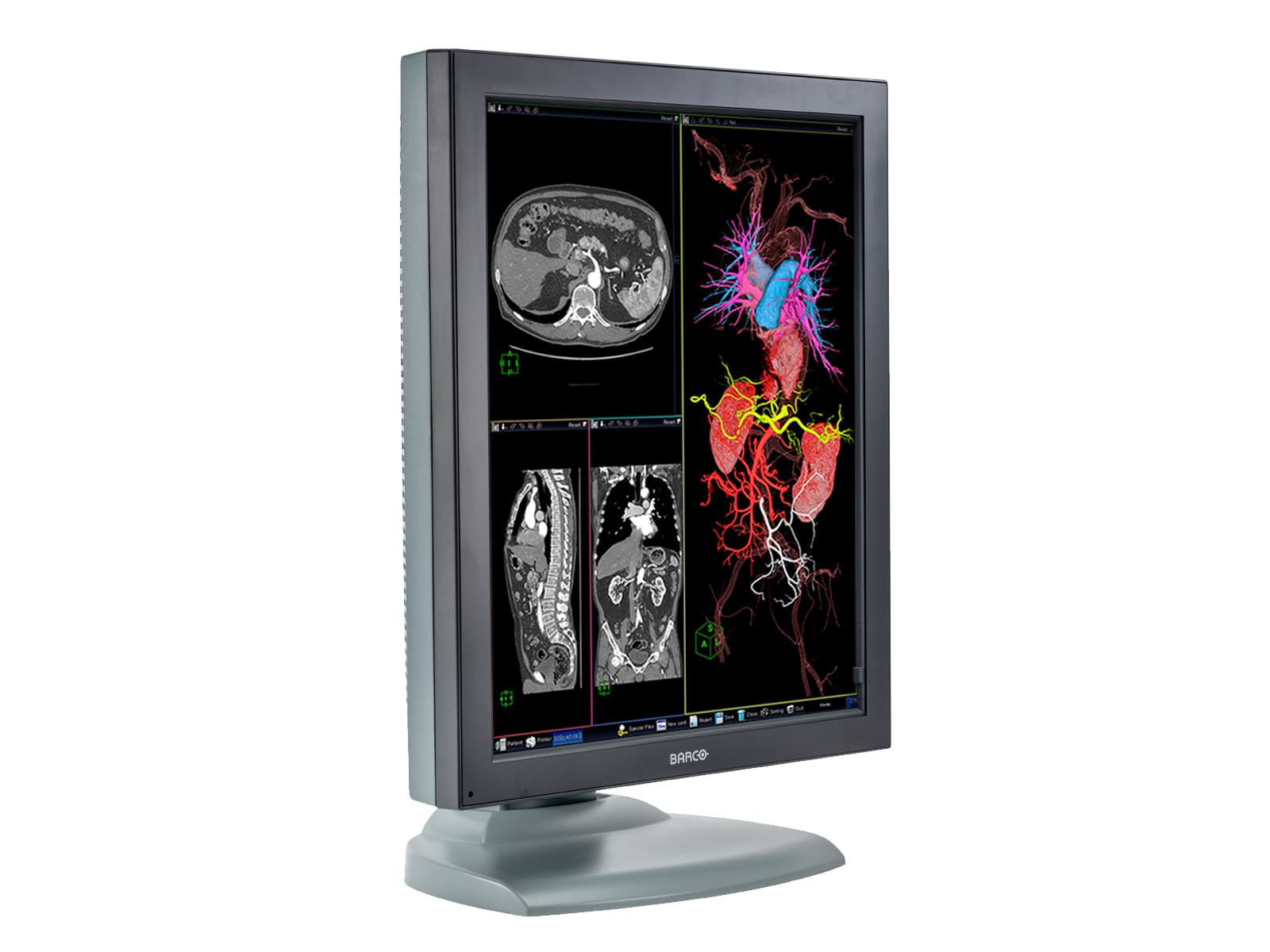 Barco Nio MDNC-3121 HighBright 3MP 21" Color Medical Diagnostic Radiology Monitor Monitors.com 