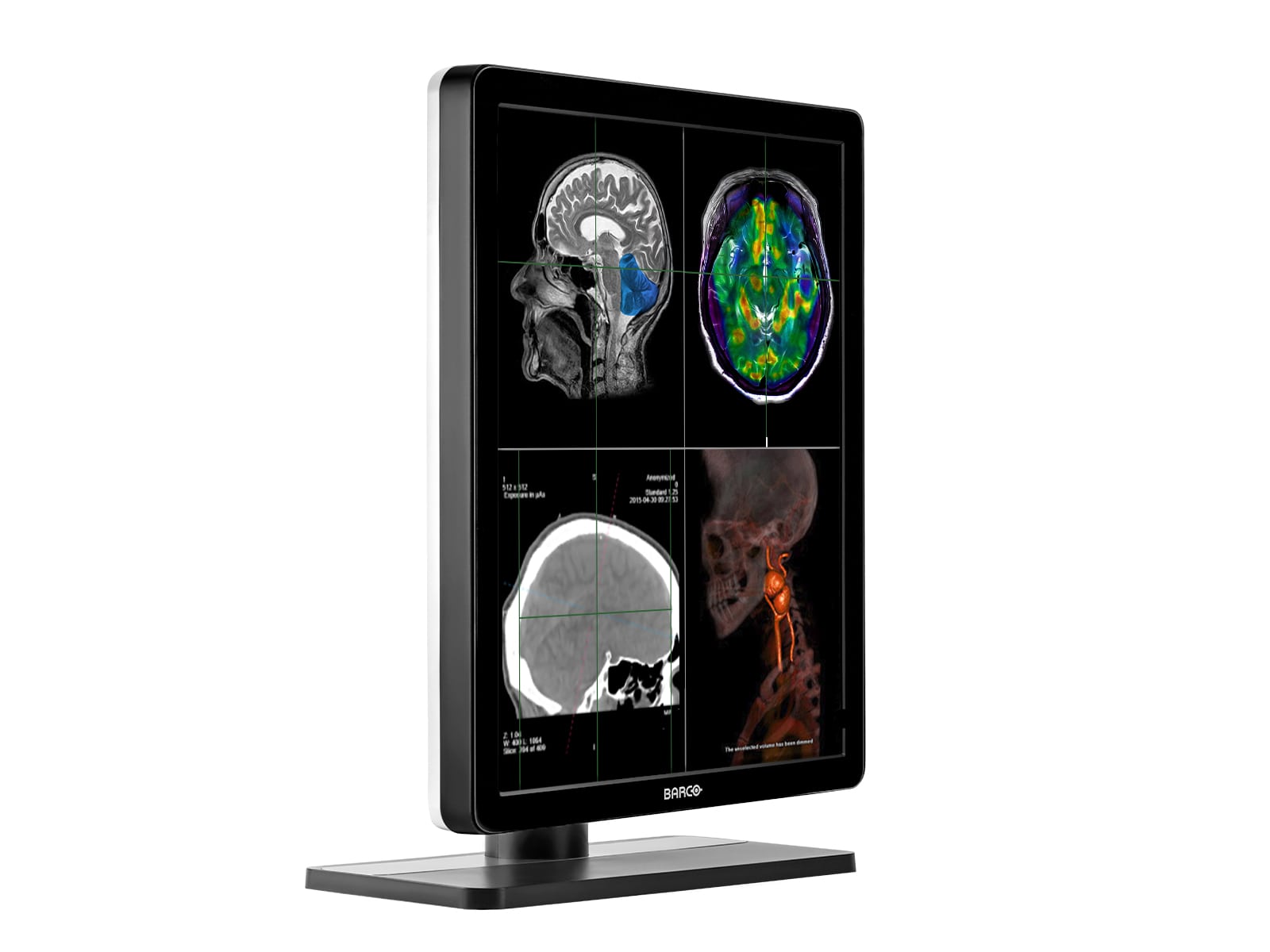 Barco Nio MDNC-2221 2MP 21" Color LED Diagnostic Radiology Display Monitor Monitors.com 