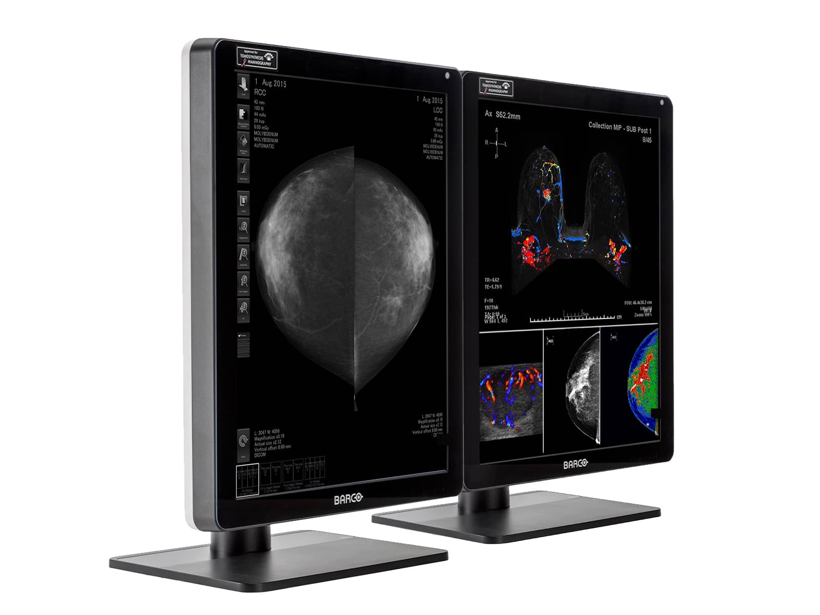 Imagen - Barco Nio MDNC-6121 5MP 21" Color LED Mammo 3D-DBT Breast Imaging Display Monitors.com 