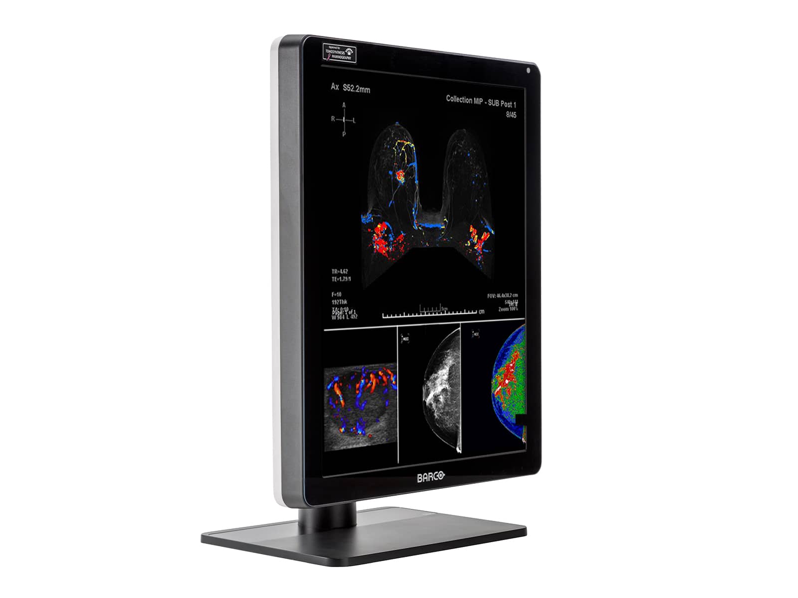 Imagen - Barco Nio MDNC-6121 5MP 21" Color LED Mammo 3D-DBT Breast Imaging Display Monitors.com 