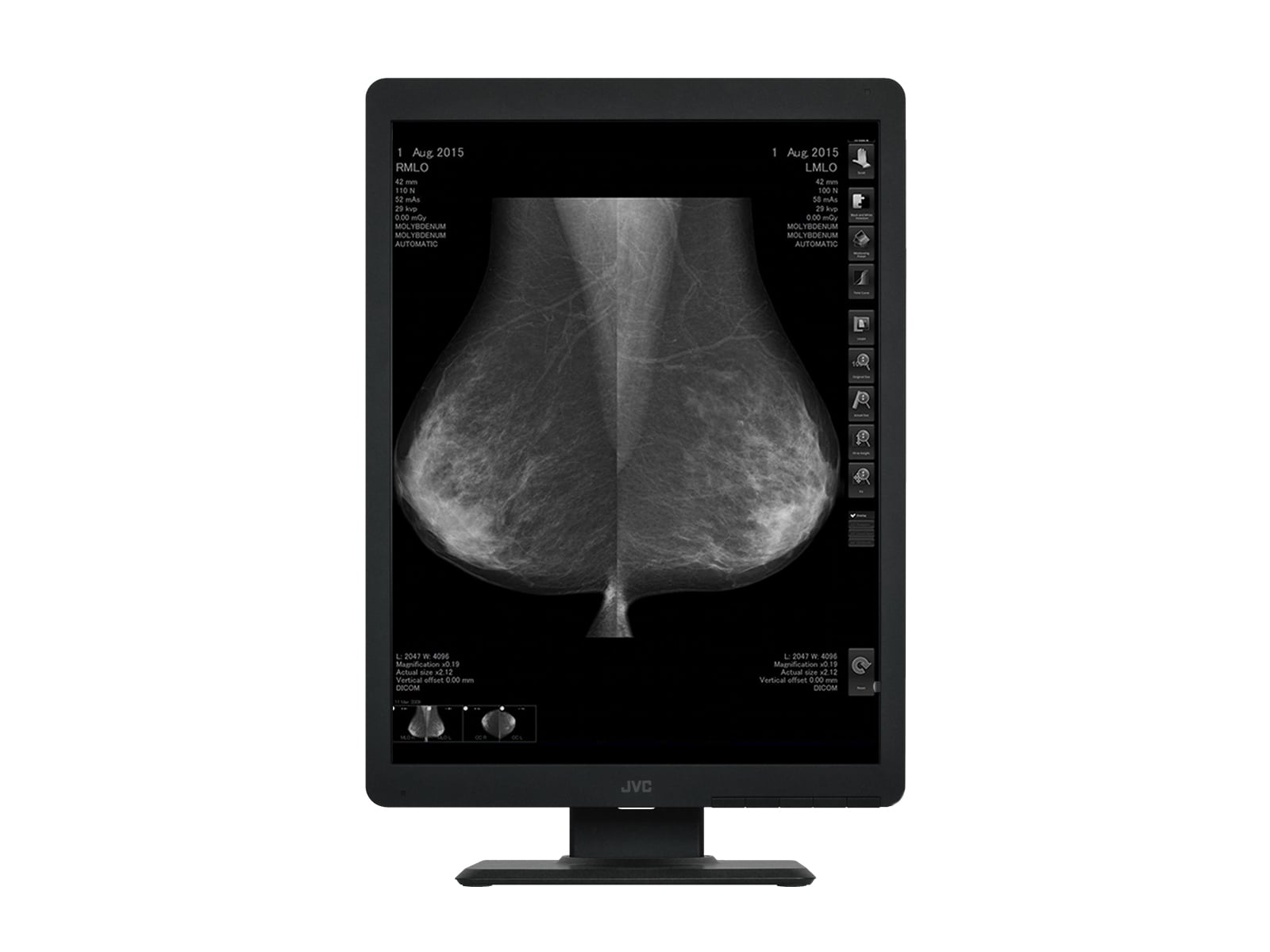 Vidar CAD Pro Advantage Mammography Film Digitizer (15790-002) Monitors.com 