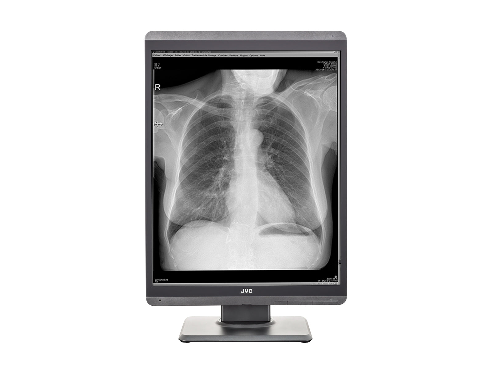 JVC Totoku MS-S200 2MP 21" Grayscale Diagnostic Radiology Display Monitor (MS-S200) Monitors.com 