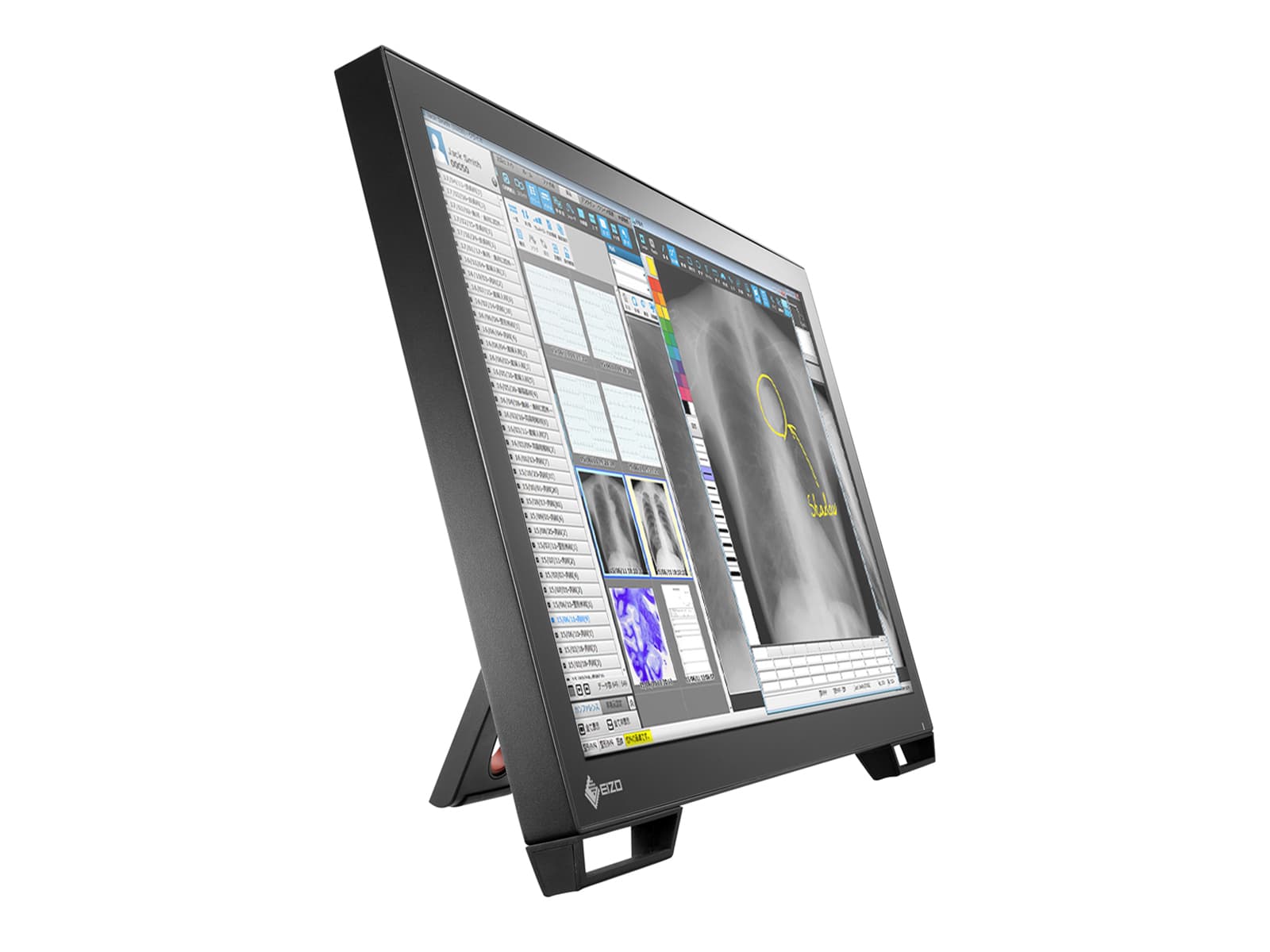 Eizo Radiforce MS236WT 2MP 23" Multi-Touch Color Clinical Review LED Dental Monitor with Stylus Pen (MS236WT) Monitors.com 