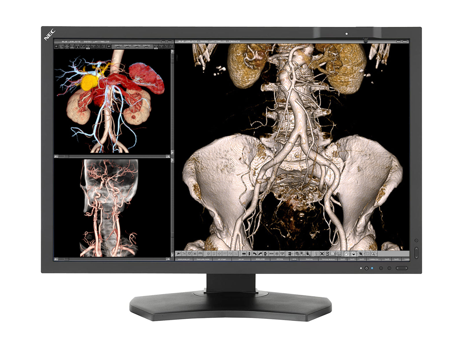 NEC MultiSync MD302C4 4MP 30" General Radiology PACS Display (MD302C4) Monitors.com 