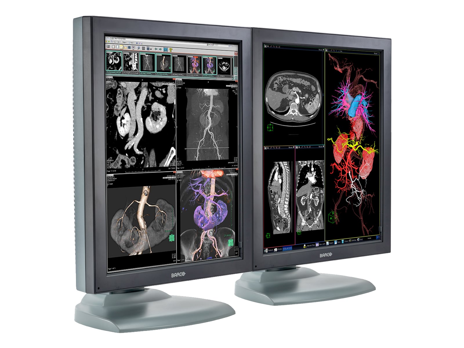 Barco Nio MDNC-3121 HighBright 3MP 21" Color Medical Diagnostic Radiology Monitor Monitors.com 