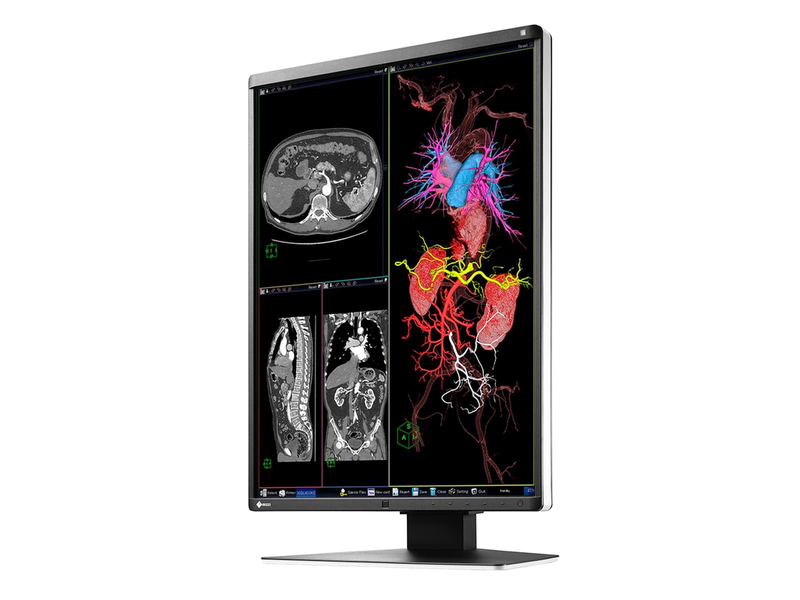 Eizo RadiForce RX360 3MP 21" Color LED General Radiology PACS Display Monitor (RX360) Monitors.com 