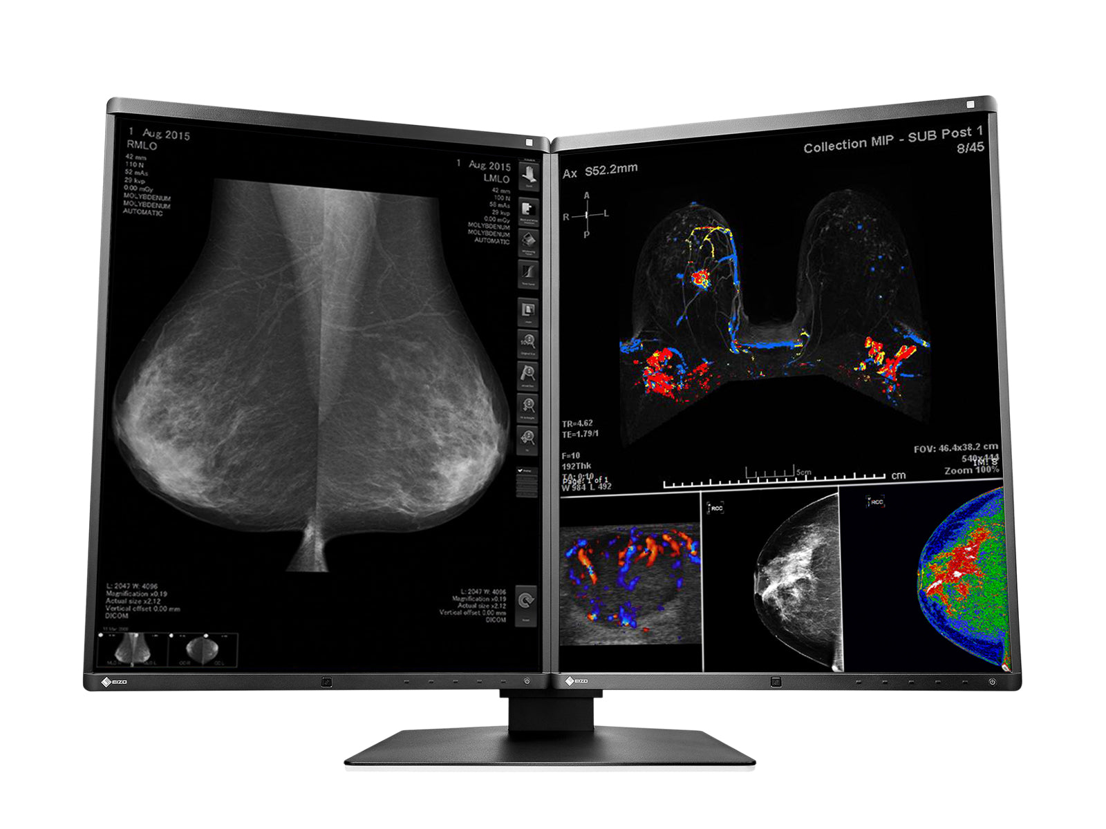 Eizo RadiForce RX560 5MP 21" Color LED Mammo 3D-DBT Breast Imaging Display (RX560-BK) Monitors.com 