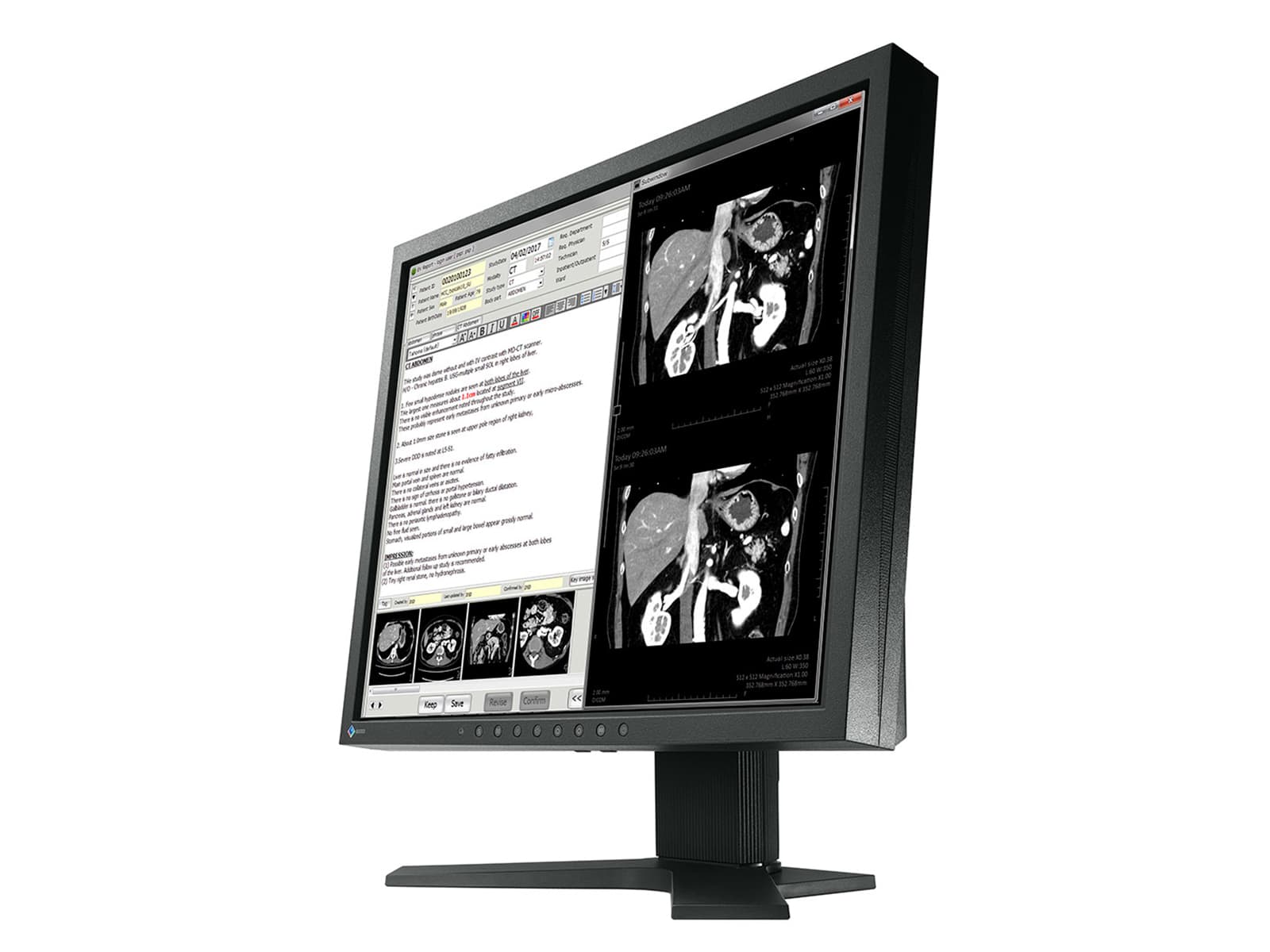 Eizo RadiForce MX191 1MP 19" Color Clinical Review Monitor (MX191) Monitors.com 