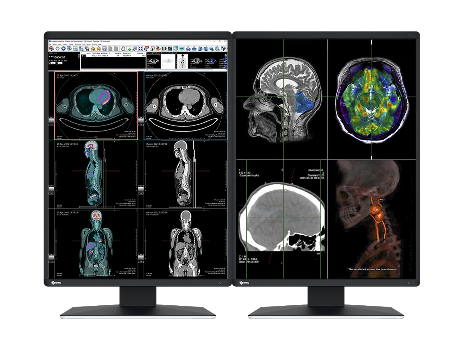 Complete PACS Gen Radiology Station | Eizo Displays | HP Workstation