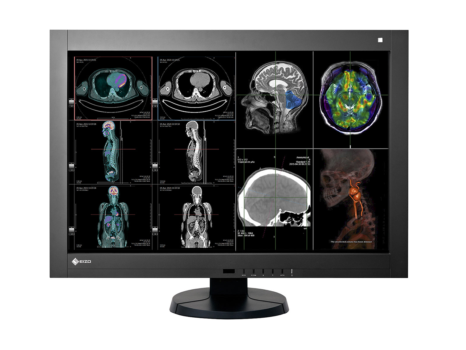 Complete PACS workstation | Eizo RX440 Display | HP Workstation